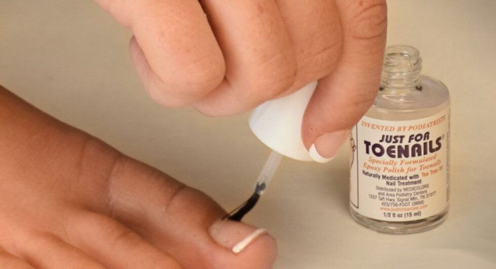 Nail polish against fungus on the big toe