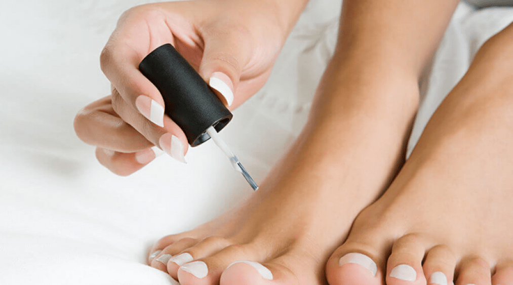 Treating fungus on the thumb with nail polish