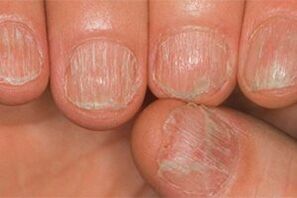The lesion of the mushroom