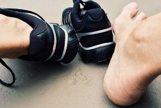 The causes of the appearance of the mycosis of the legs