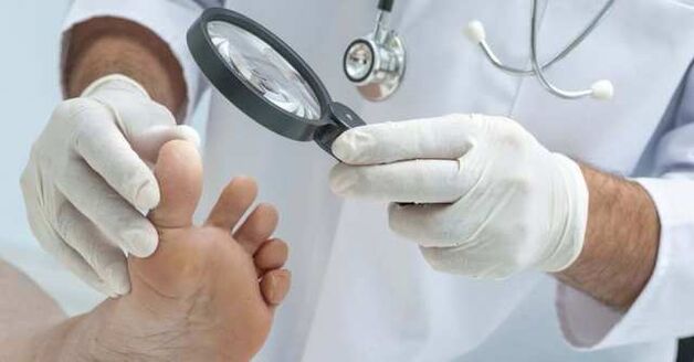 Examination of feet for fungal infections