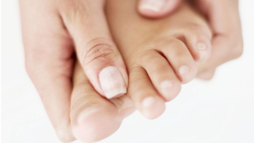 Itching caused by nail fungus on the big toe