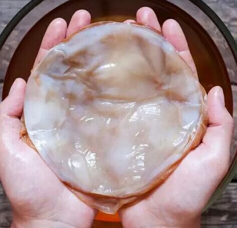 Nail fungus kombucha