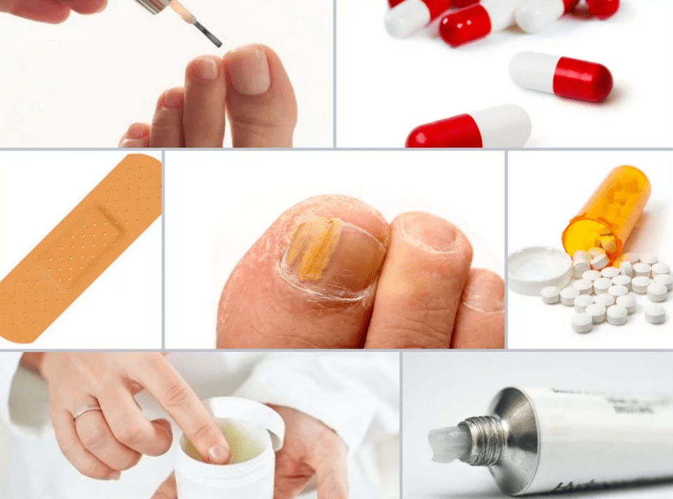 systemic drugs for toenail fungus